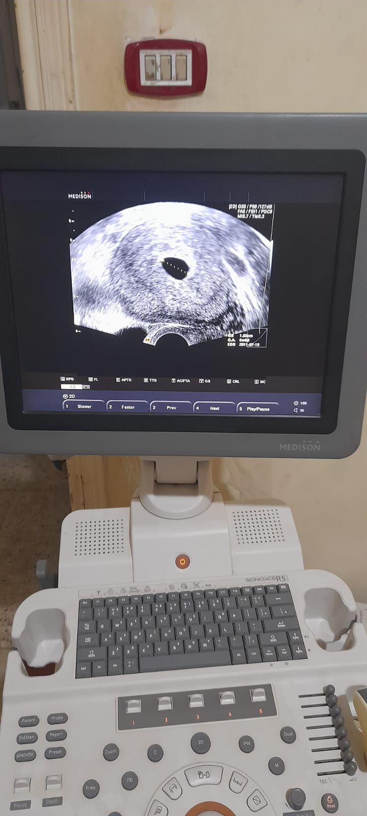 جهاز سونار M4 Medical - 1