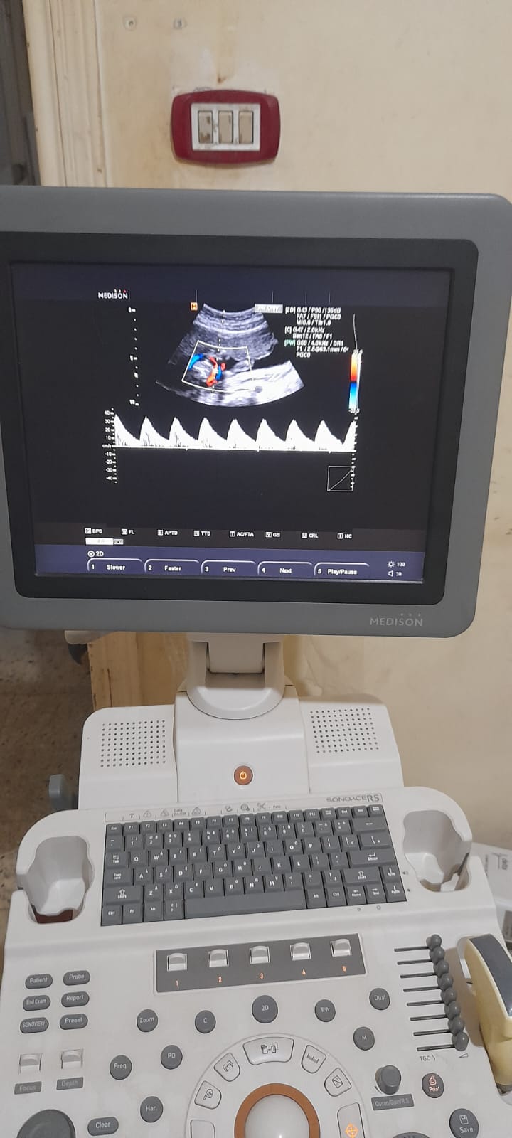 جهاز سونار M4 Medical - 2